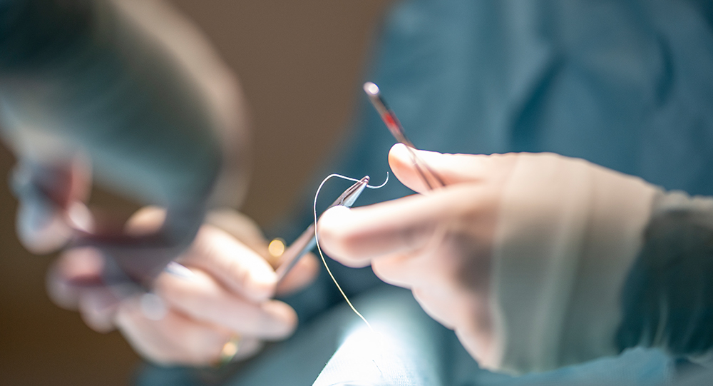 Minimal Surgery, Maximum Effect