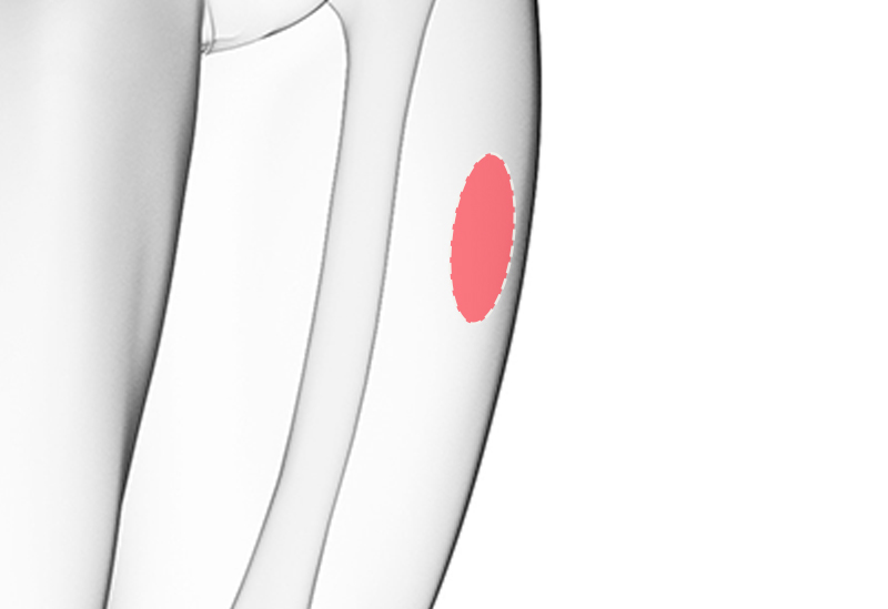 フィラー＆自己脂肪