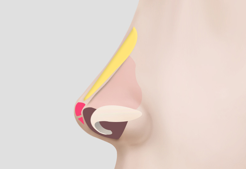 縫合および形態修正