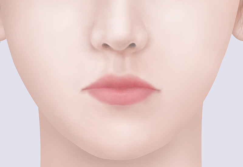 縫合および形態矯正