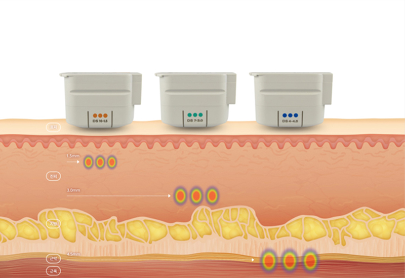 カスタム深度設計